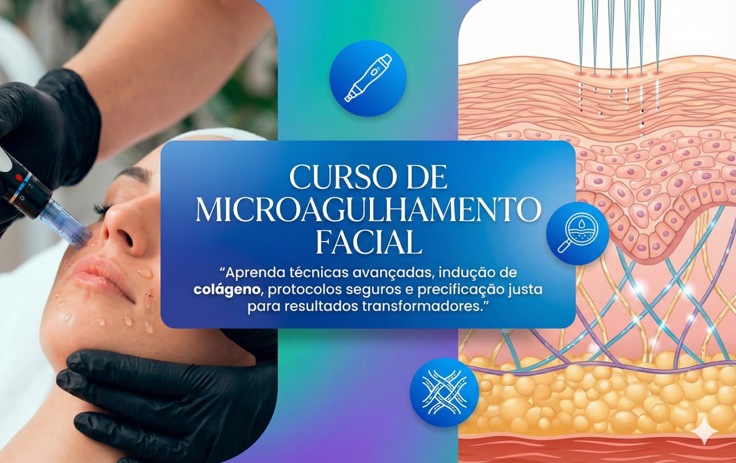 Microagulhamento Facial